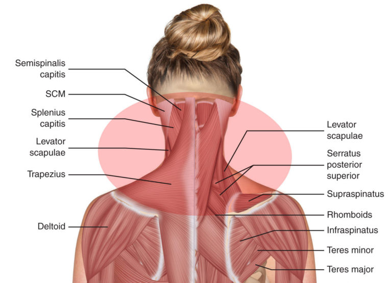 neck-shoulders-fusionteachertraining